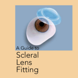 Scleral Lenses fitting process