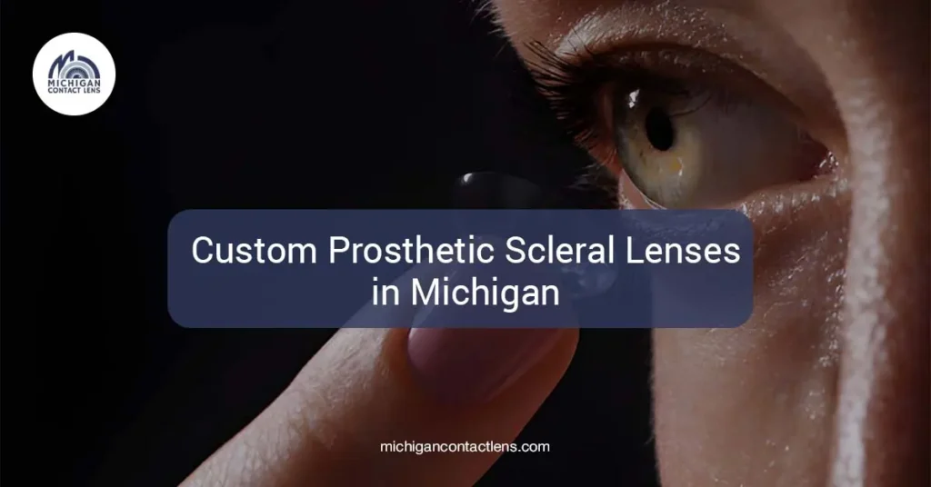 Prosthetic Scleral lenses