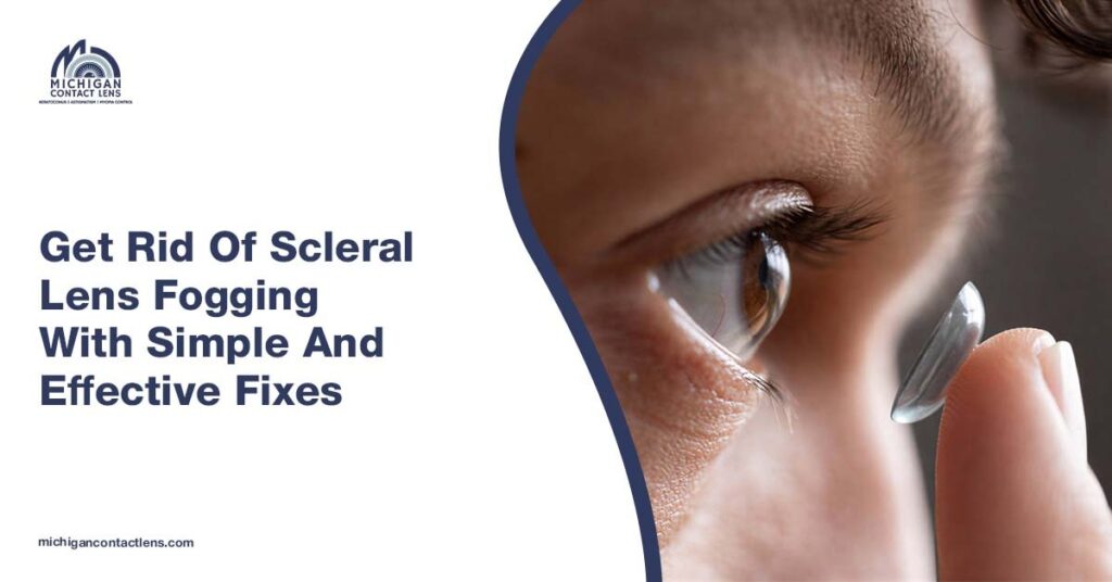 Michigan Contact Lens | Why Are My Scleral Lenses Fogging Up? Causes and Real Fixes Get Rid Of Scleral Lens Fogging With Simple And Effective Fixes