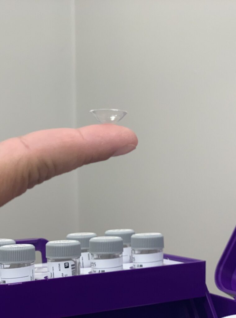 A diagnostic scleral lens from a fitting kit, used by a Dry Eye Specialist in Detroit to find a custom fit.